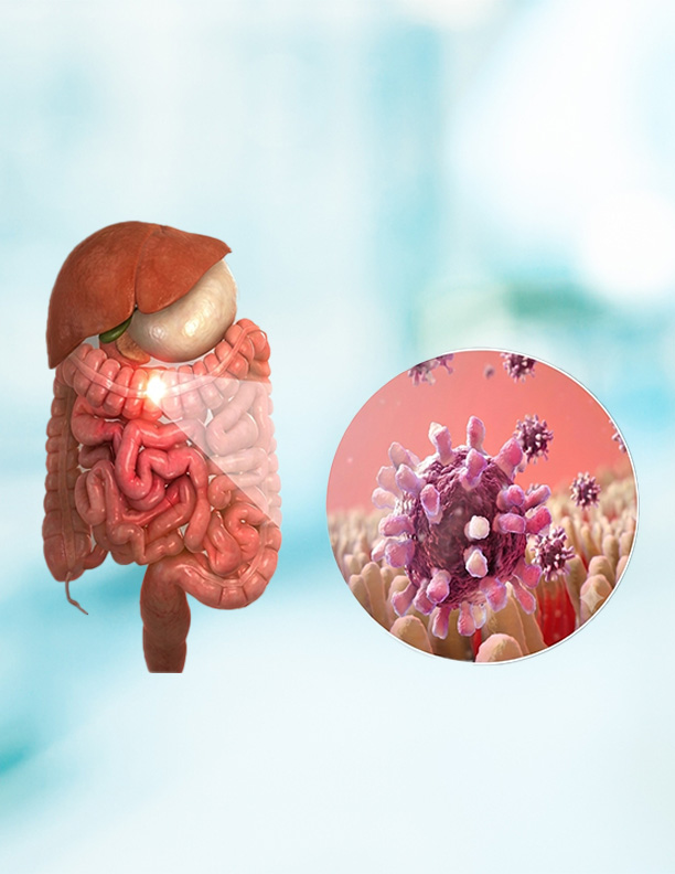 GI cancer