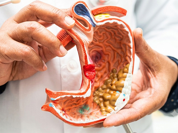 Early Gi cancer screening